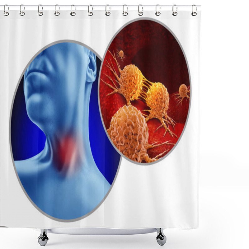 Personality  Throat Cancer As Abnormal Cell Growth As Aryngeal Or Pharyngeal And HPV Related Cancers As A Patient With A Tumor In The Neck With 3D Illustration Elements. Shower Curtains