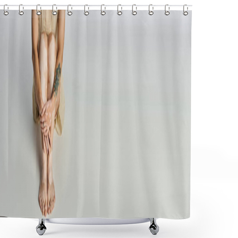 Personality  A Young Woman With Vitiligo Exudes Beauty And Confidence In A Serene Setting. Shower Curtains