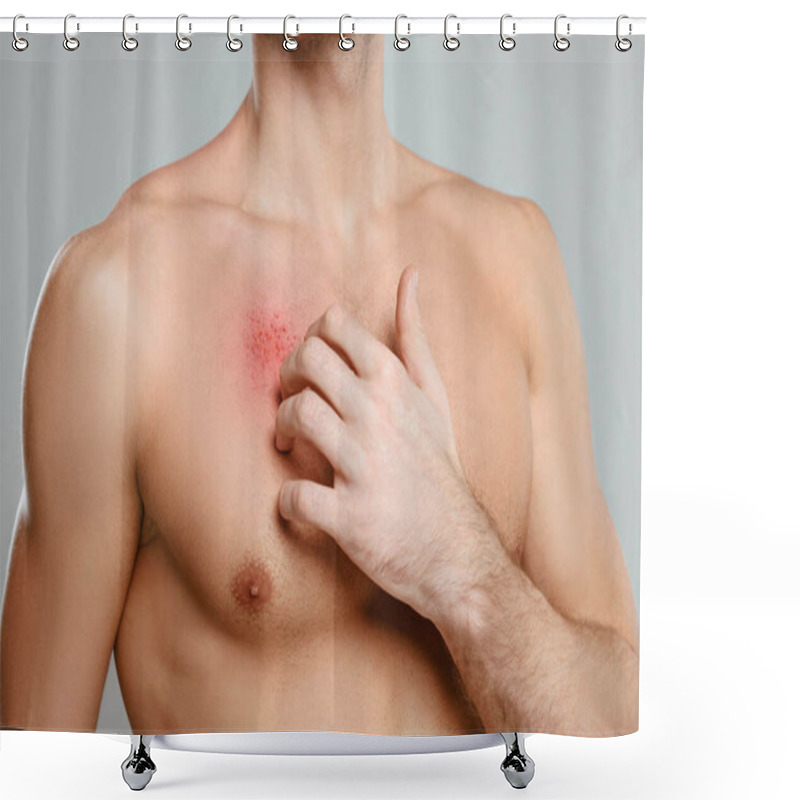 Personality  Partial View Of Man Scratching Skin With Allergy Isolated On Grey Shower Curtains