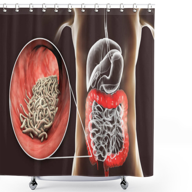 Personality  Parasitic Worms In Human Large Intestine, 3D Illustration. Enterobius Vermicularis And Other Round Worms Shower Curtains