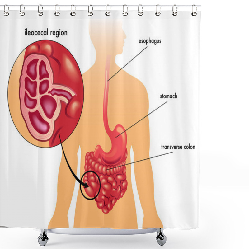 Personality  Colitis Shower Curtains