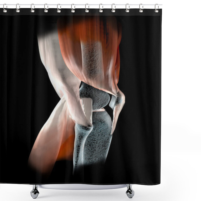 Personality  Knee Ligaments, Tendons, Bones Shower Curtains