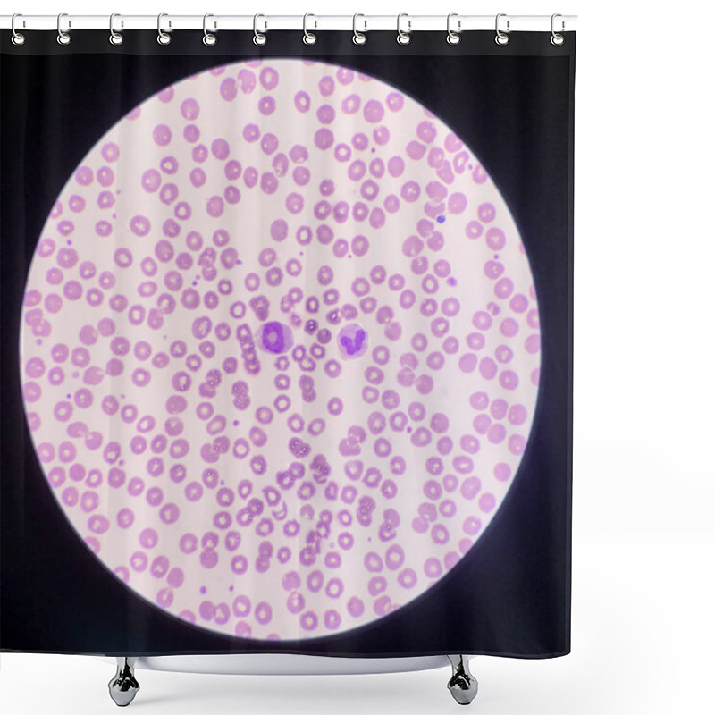 Personality  Abnomal Neutrophil Donut Shape In Leaf. Shower Curtains