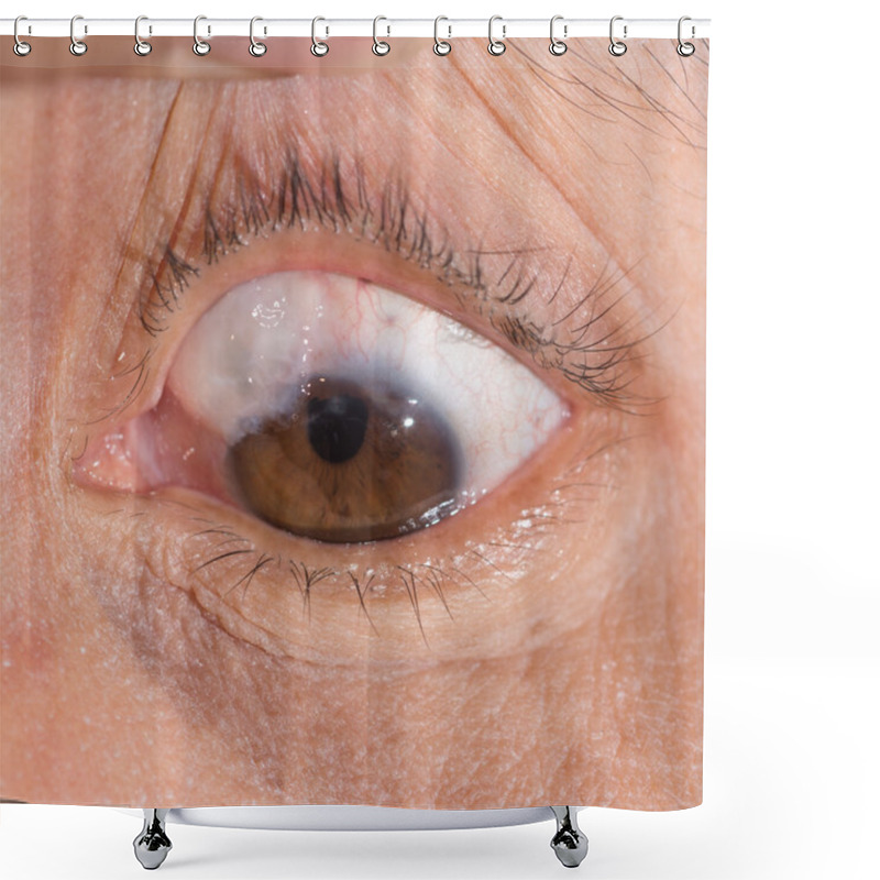 Personality  Trabeculectomy Bleb Eye Test Shower Curtains