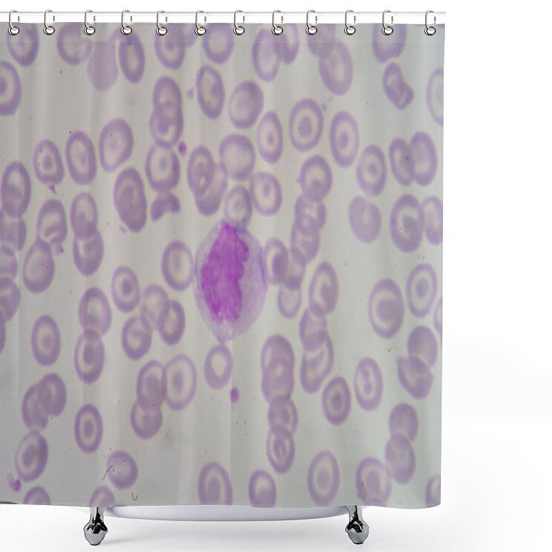 Personality  Monocyte Shower Curtains