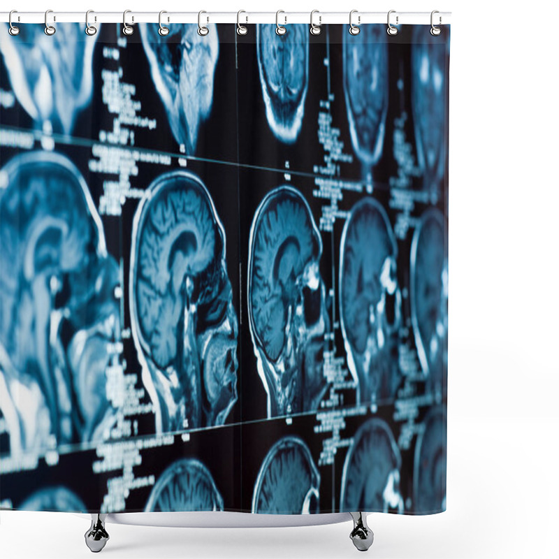 Personality  Closeup Of A CT Scan With Brain And Skull On It Shower Curtains