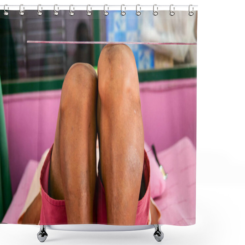 Personality  Leg Length Discrepancy (LLD) Shower Curtains