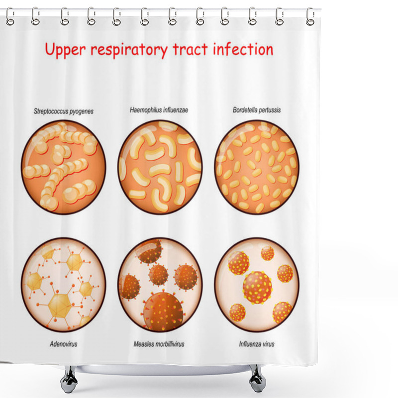 Personality  Upper Respiratory Tract Infection. Close-up Of Causative Agents Of Tonsillitis, Nasal Obstruction, Sore Throat, Pharyngitis, Laryngitis, And Sinusitis: Viruses (Adenovirus, Influenza, Measles Morbillivirus), And Bacteria (Bordetella Pertussis, Haemop Shower Curtains