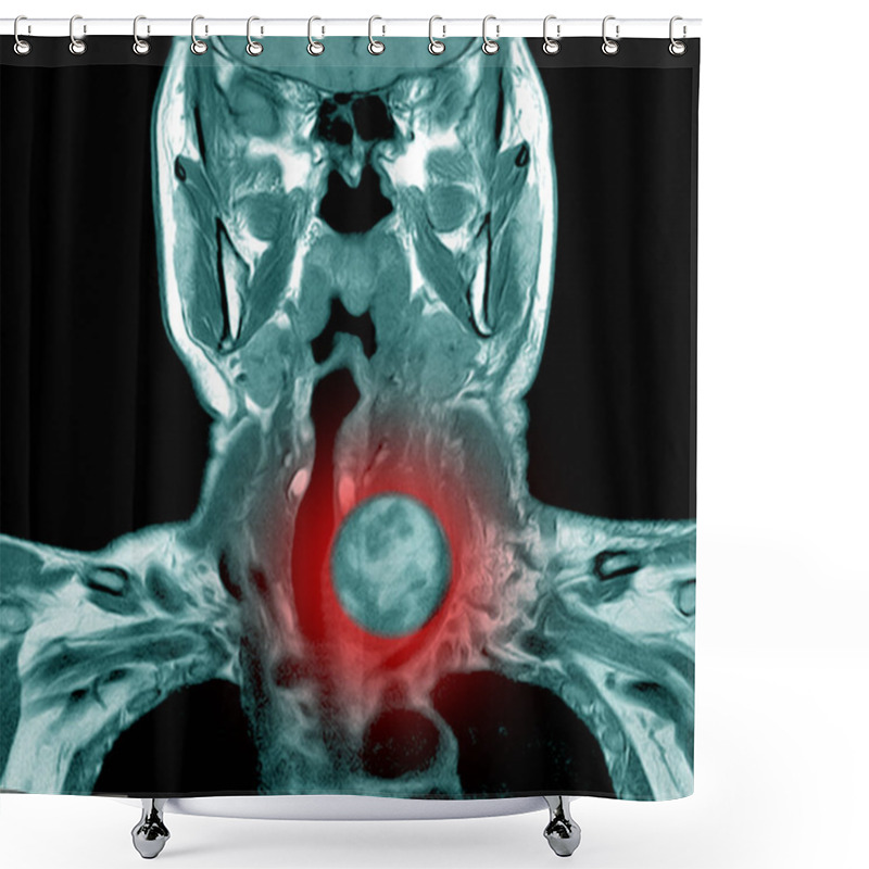 Personality  Magnetic Resonance Imaging (MRI) Of Neck, Shower Curtains