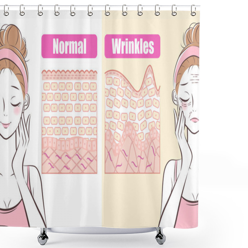 Personality  Woman With Wrinkles Problem Concept Before And After Shower Curtains