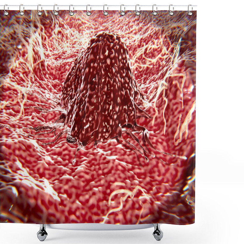 Personality  3d Computer Illustration Of A Migrating Cancer Cell. Cancer Cells Can Migrate To Other Body Tissues Or Organs Building Metastasis. Shower Curtains