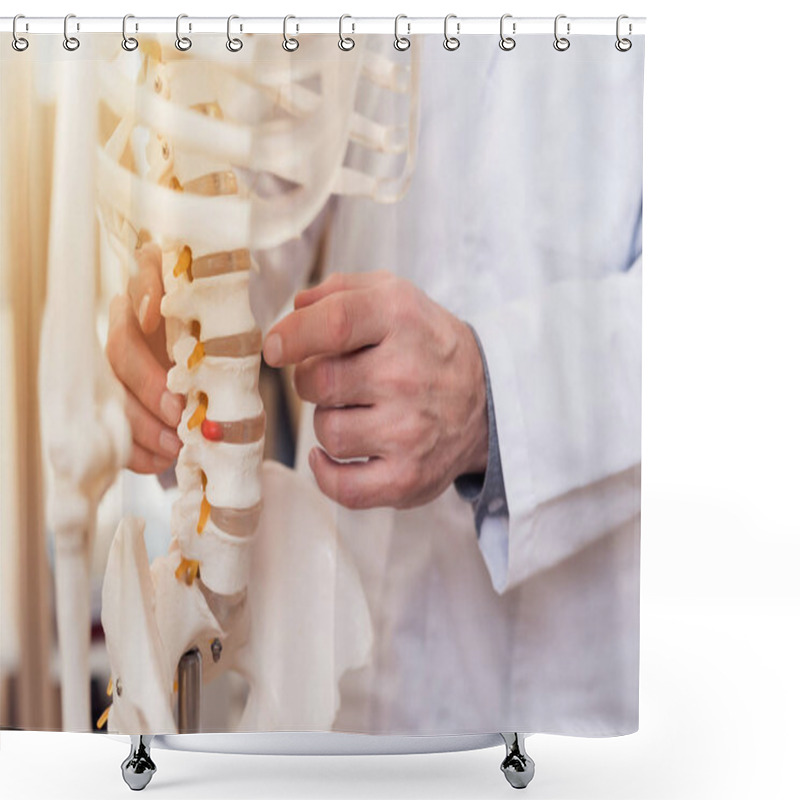 Personality  Close Up. Doctor Is Showing Vertebrae On Skeleton. Shower Curtains