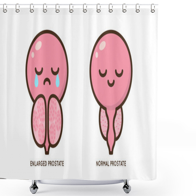 Personality  Cartoon Benign And Prostate Vector Illustration. Icon Character Of Male Urology Inflammation Disease. Flat Design For Diagram, Medical Journal Article. Prostatitis, Enlarged,obstruction,hypertrophy Shower Curtains