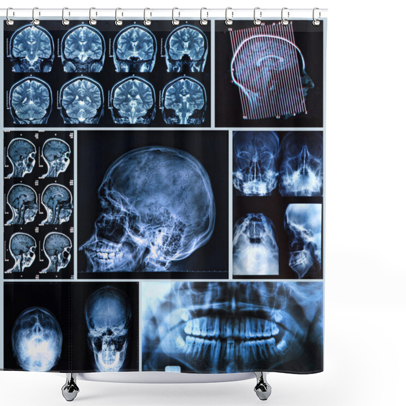 Personality  Head And Neck Anatomy Shower Curtains