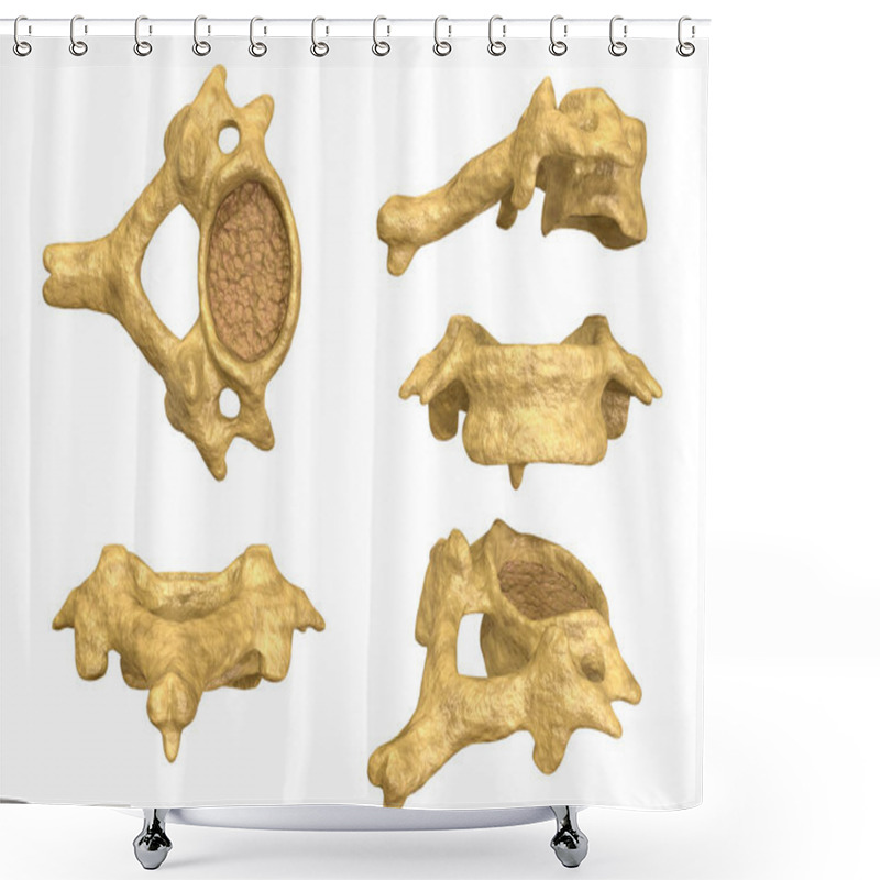 Personality  Morphology Of The Cervical Vertebra, Sixth Cervical Vertebra, Multiple Angles And Views Shower Curtains