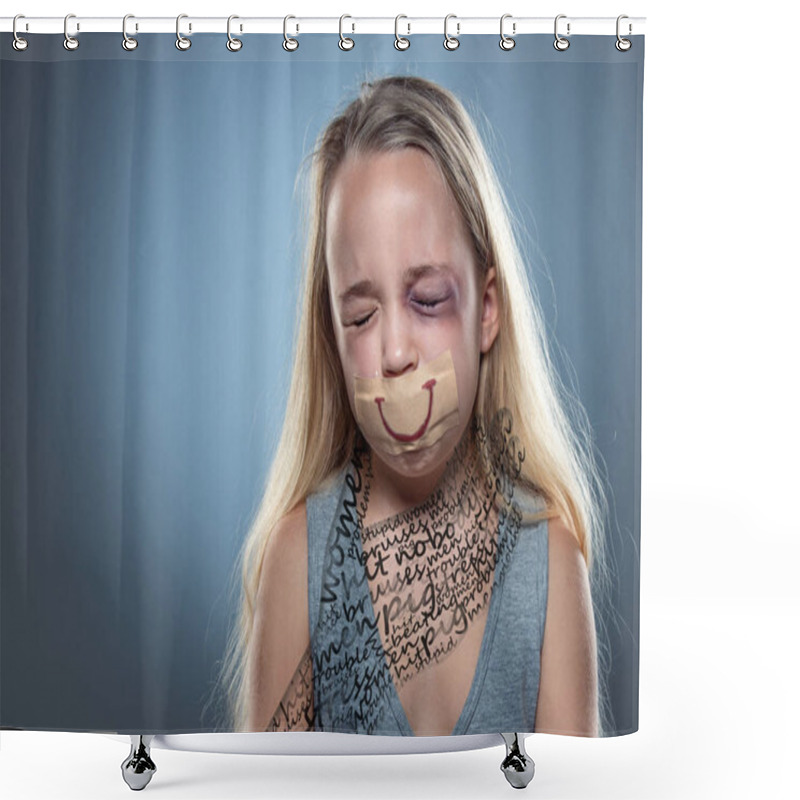 Personality  Sad And Frightened Little Girl With Bloodshot And Bruised Eyes, Fiction Of Happiness Shower Curtains