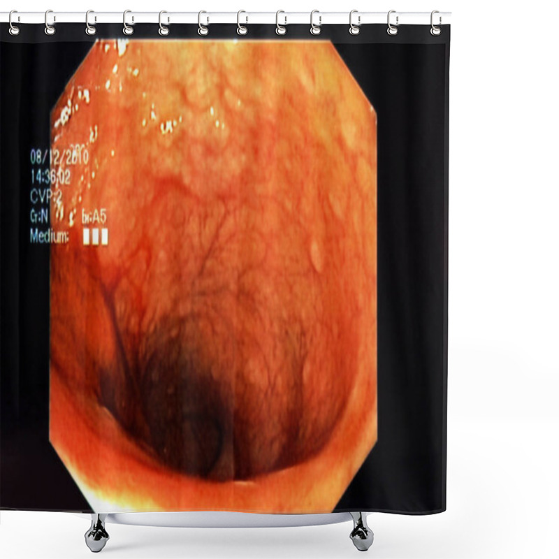 Personality  Endoscopy Close Up Shot Shower Curtains