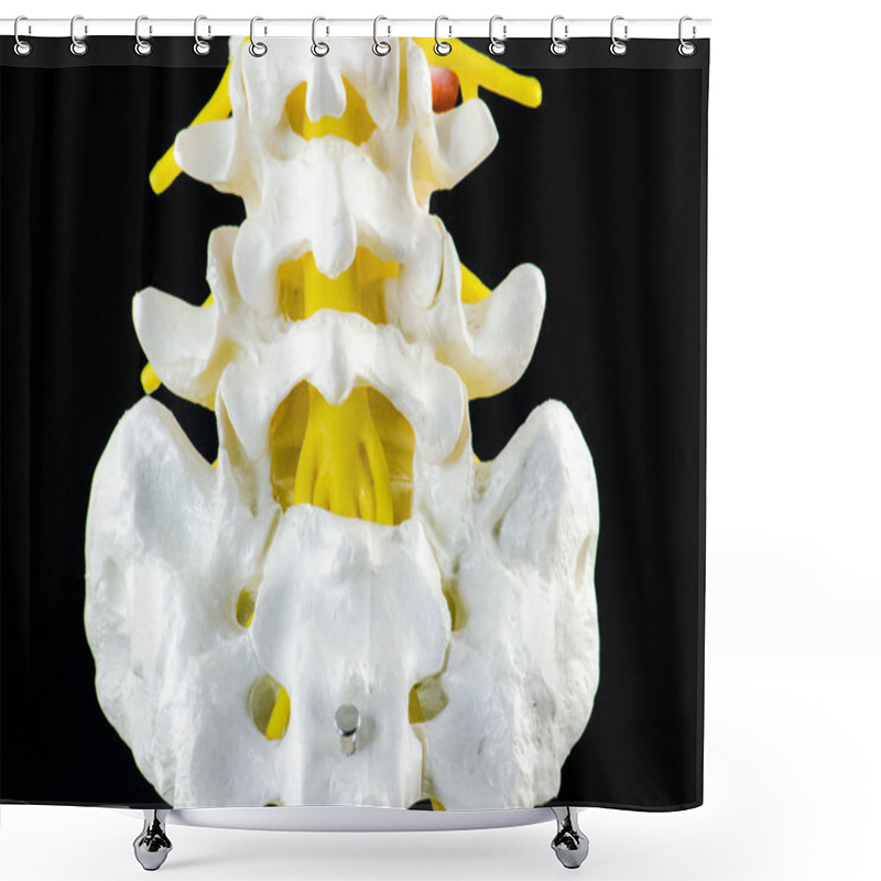 Personality  Spine Model, Vertebra Model Shower Curtains