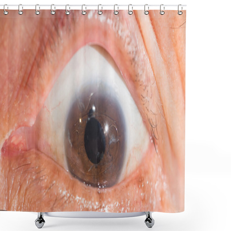 Personality  Senile At Eye Test Shower Curtains