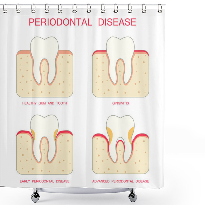 Personality  Tooth Periodontal Disease Shower Curtains