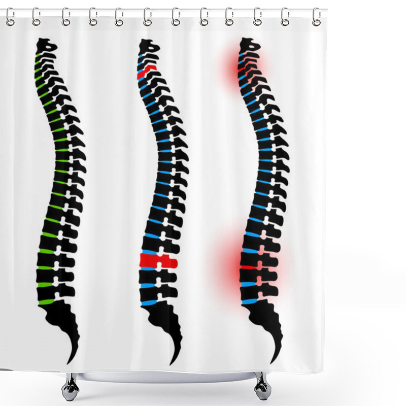 Personality  Human Spine Silhouettes Shower Curtains