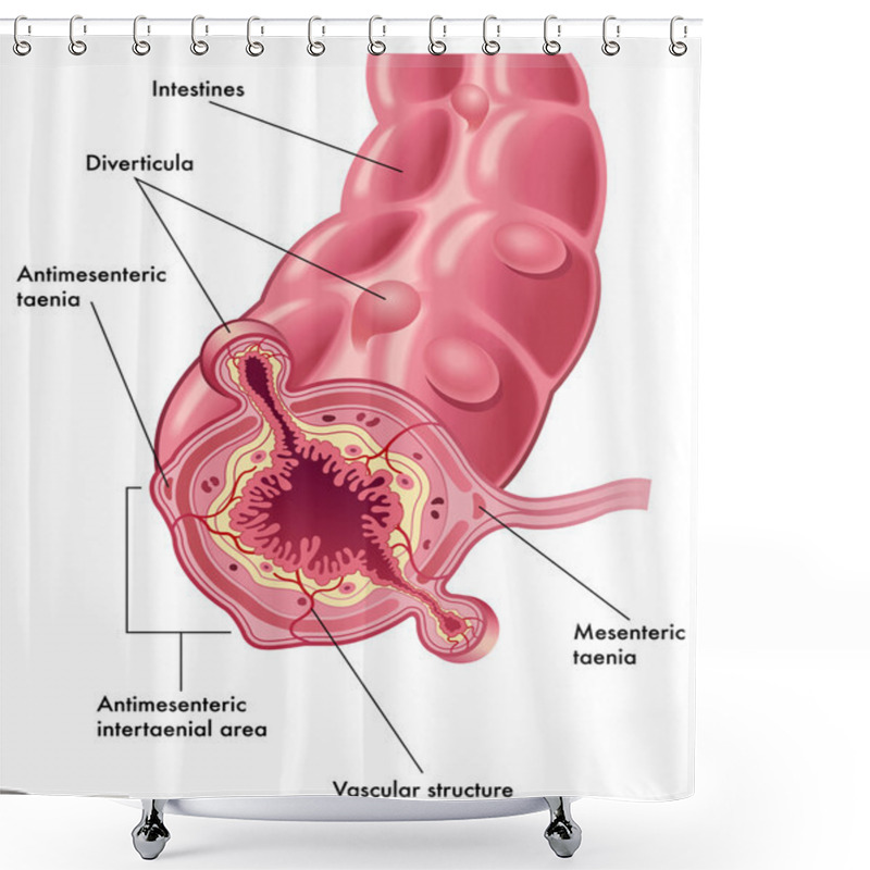 Personality  Diverticula Shower Curtains