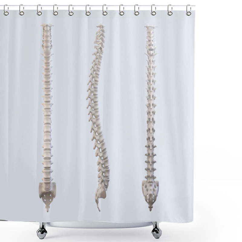 Personality  Human Vertebrae Anatomy. Spine Vertebral Shower Curtains