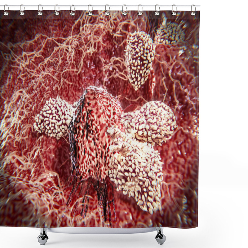 Personality  T Lymphocytes Attacking Cancer Cell; 3D-rendering Natural Killer Cells Are A Type Of Lymphocytes Which Destroy Cancer Cells And Other Altered Cells Releasing Cytotoxic Granules. Illustration Shower Curtains