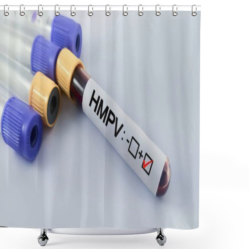 Personality  Human Metapneumovirus (HMPV) Blood Test  Shower Curtains