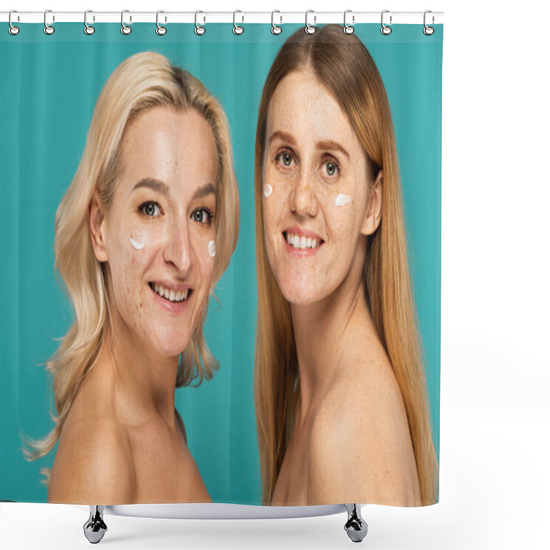 Personality  Cheerful Women With Different Skin Conditions And Cream On Faces Looking At Camera Isolated On Turquoise  Shower Curtains