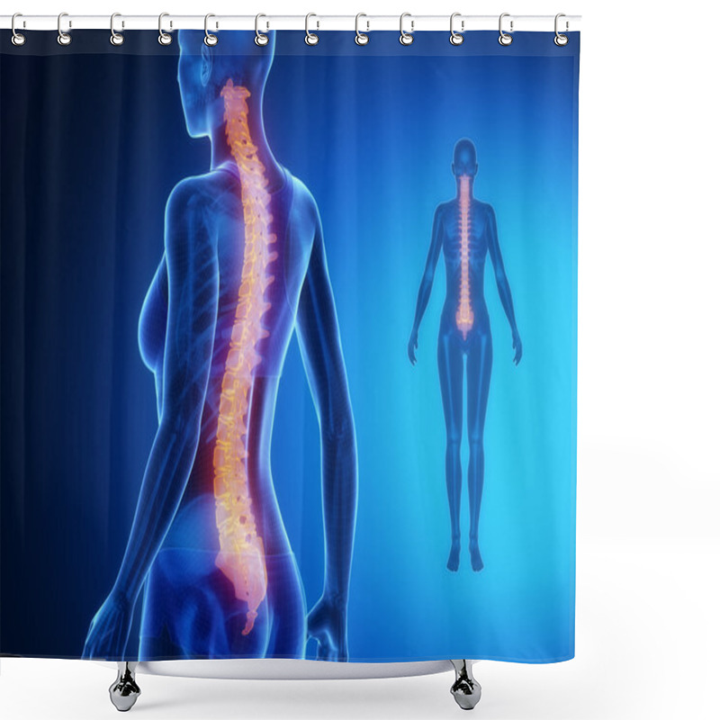 Personality  SPINE Blue X--ray Bone Scan Shower Curtains