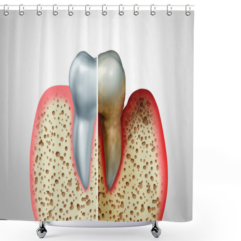 Personality  Gum Disease Shower Curtains