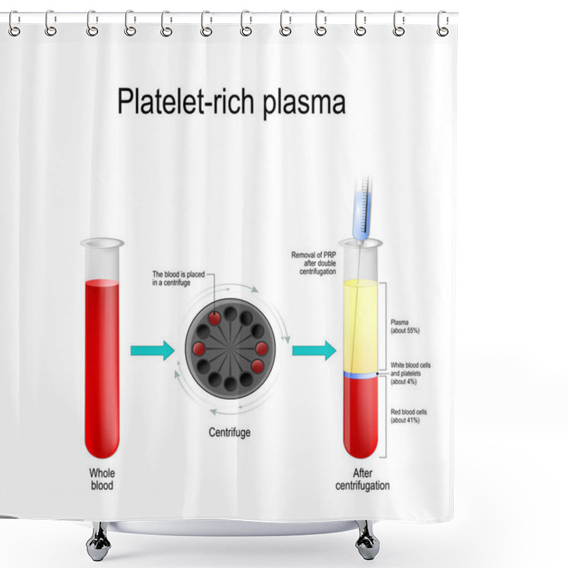 Personality  Platelet-rich Plasma. Autologous Conditioned Plasma, Is A Concentrate Of Platelet-rich Plasma Derived From Whole Blood, Centrifuged To Remove Red Blood Cells. Blood Test Tube, Centrifuge, Syringe, And Test Tube With Layers Of Blood Components Shower Curtains