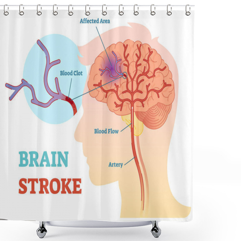 Personality  Brain Stroke Anatomical Vector Illustration Diagram, Scheme  Shower Curtains