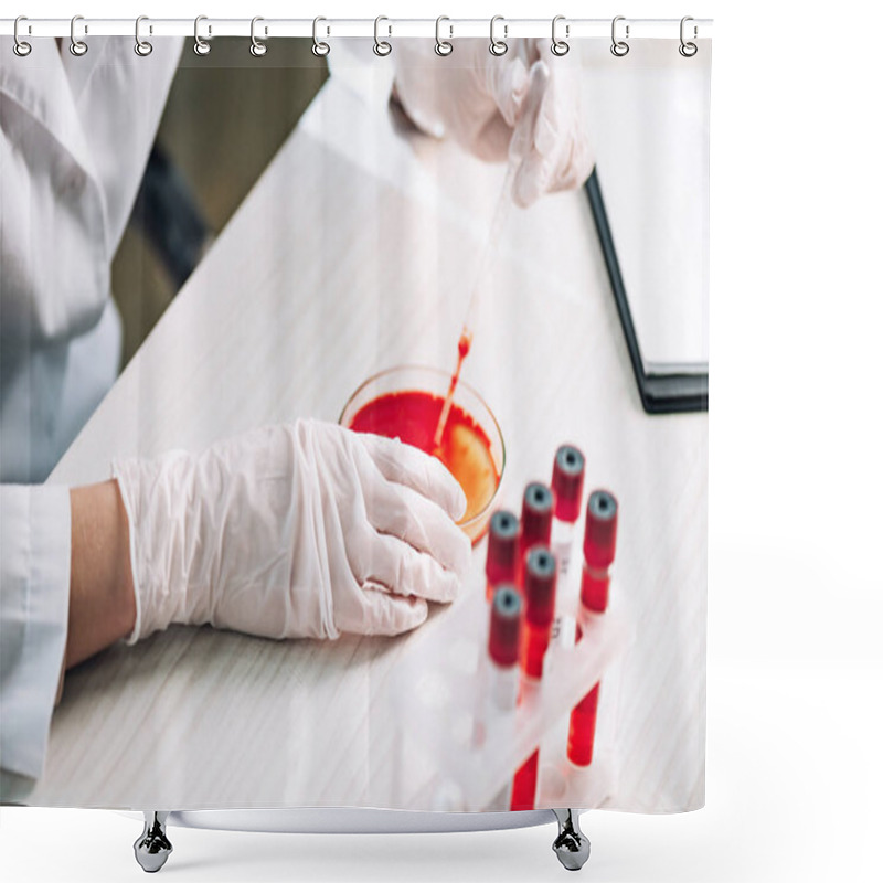 Personality  Cropped View Of Immunologist Holding Pipette With Red Liquid In Laboratory  Shower Curtains