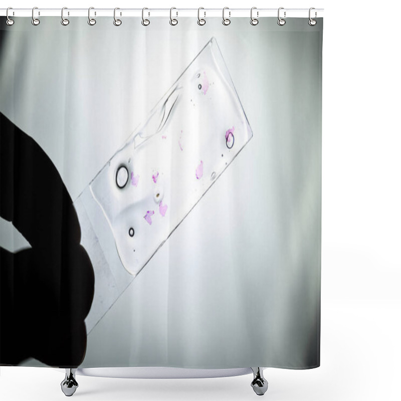 Personality  Slices Of The Tumor Under Glass. Histological Examination Of Tumor Cells For The Presence Of Cancer. Samples Of Tumor Cells Under The Sleek Against The Background Of The Lamp. Shower Curtains