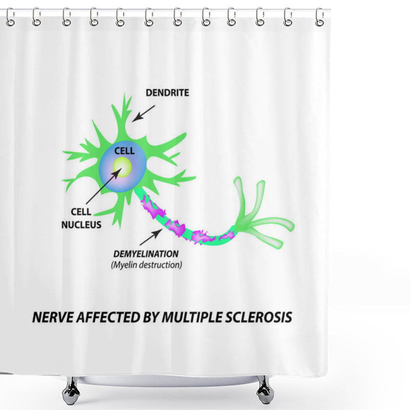 Personality  The Destruction Of The Myelin Sheath On The Axon. Damaged Myelin. Neuron Affected By Multiple Sclerosis. World Multiple Sclerosis Day. Infographics. Vector Illustration On Isolated Background. Shower Curtains