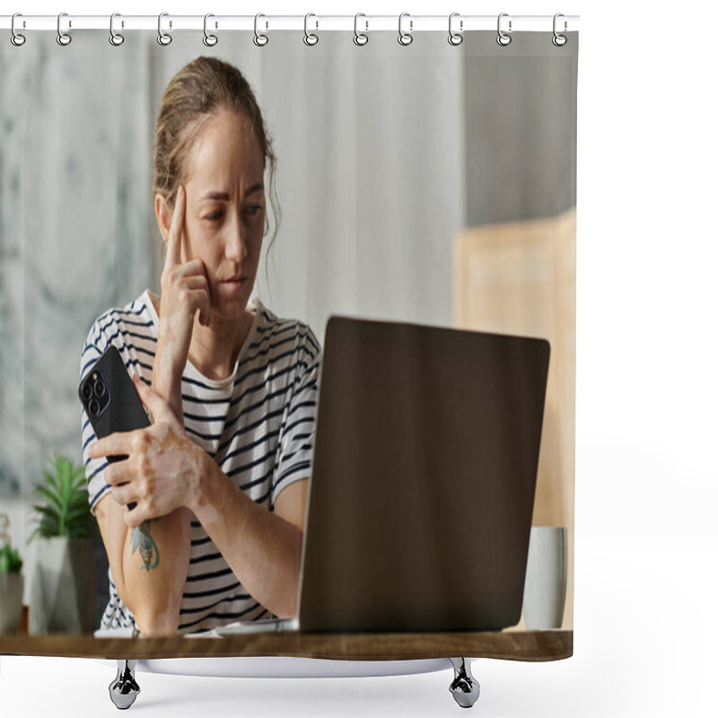 Personality  A Woman With Vitiligo Contemplates While Using A Laptop And Holding Her Phone. Shower Curtains