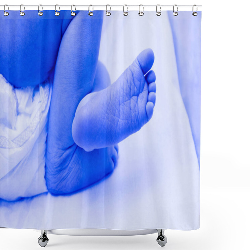 Personality  Jelundown Disease Child. Treatment Photo Shower Curtains