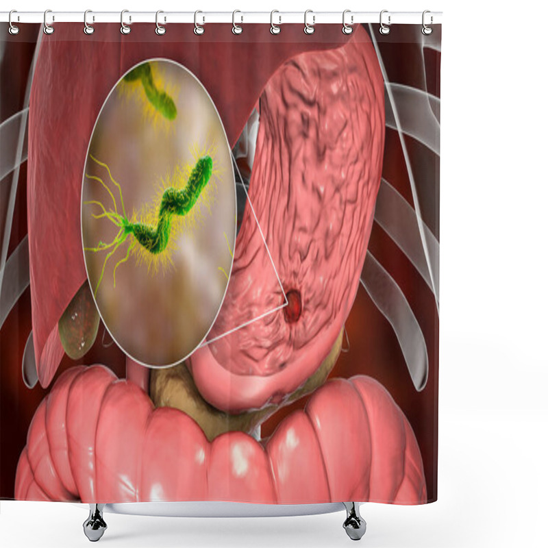 Personality  Stomach Ulcer And Closeup View Of Bacteria Helicobacter Pylori, Associated With Ulcer Formation, 3D Illustration Shower Curtains