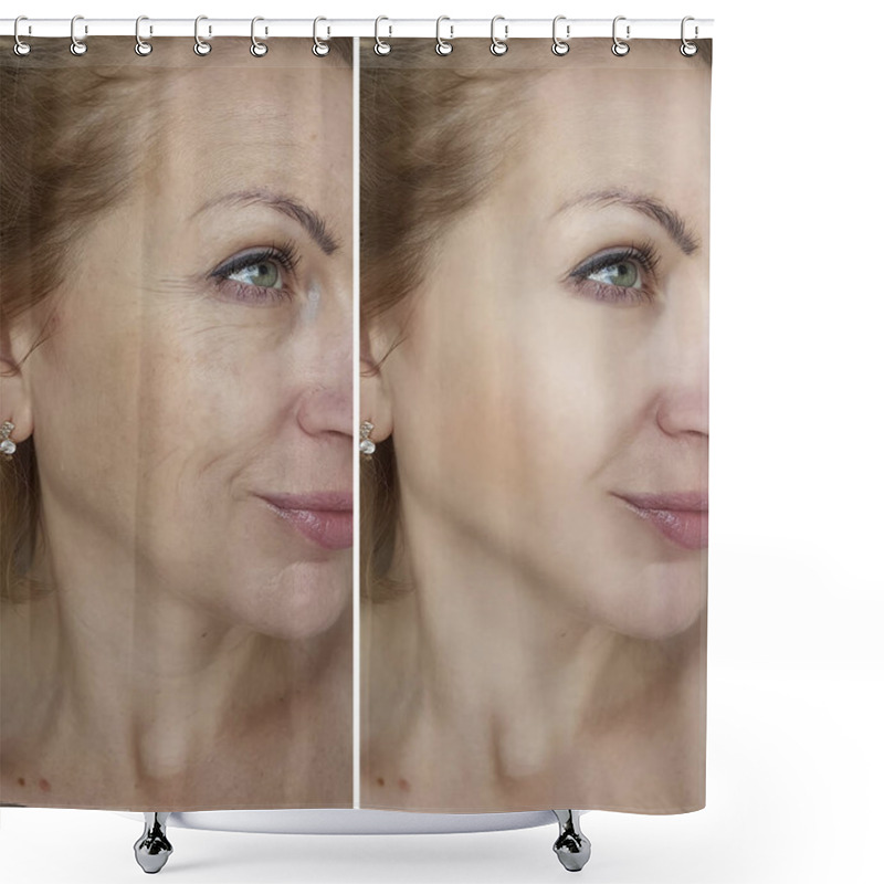 Personality  Face Woman Wrinkles Before And After Shower Curtains