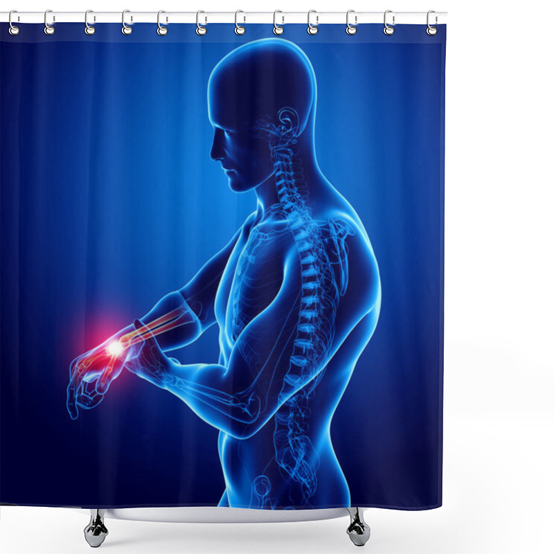 Personality  Hand Pain Anatomy In Blue Shower Curtains