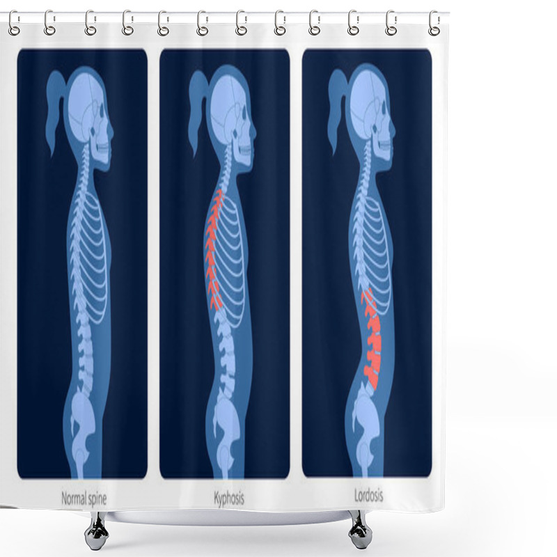 Personality  Spine X Ray Shower Curtains