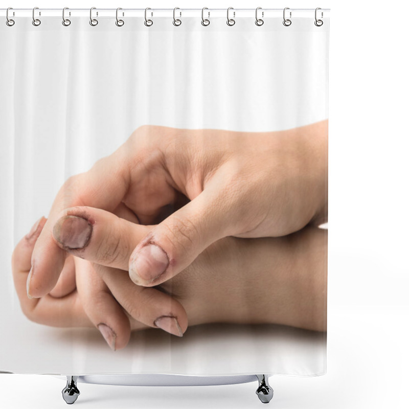 Personality  Female Hands With Dirty Nails Shower Curtains