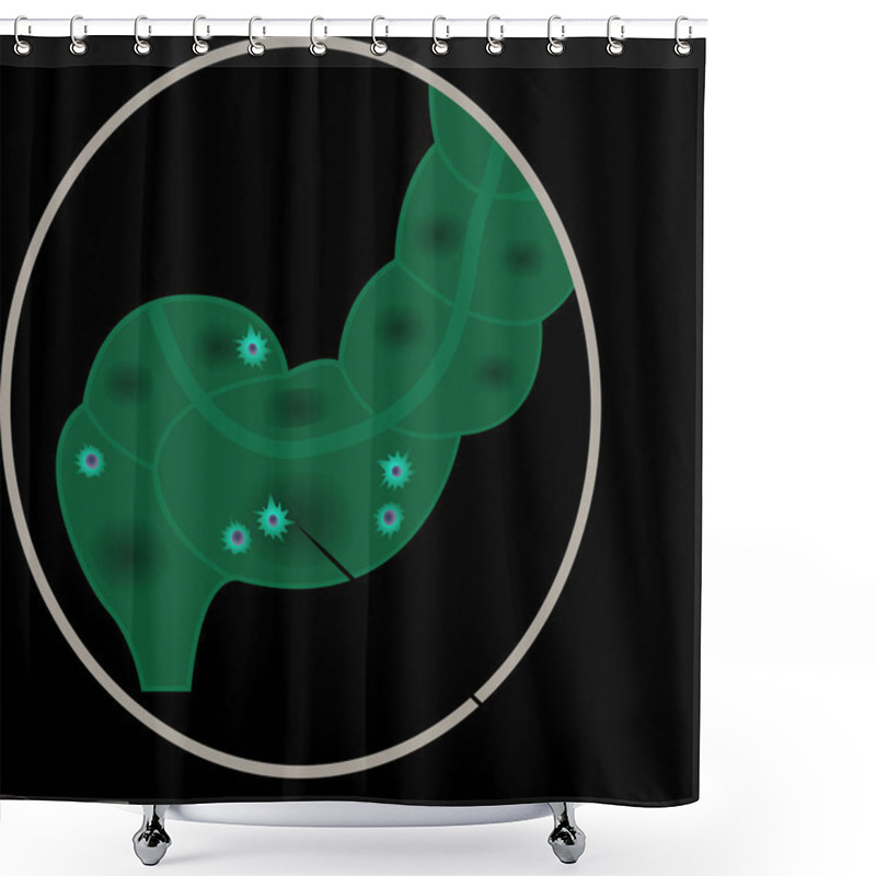 Personality  Diverticulitis Intestine Disease  Vector Graphic Illustration For Medical Use Shower Curtains