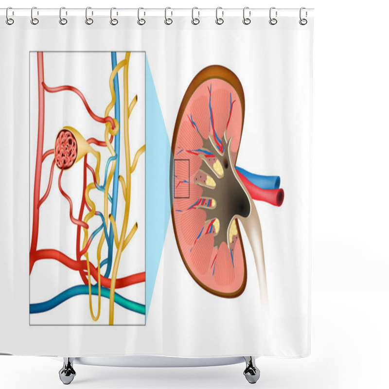 Personality  Glomerulonephritis (GN). Inflammation Either Of The Glomeruli Or Of The Small Blood Vessels In The Kidneys. Shower Curtains