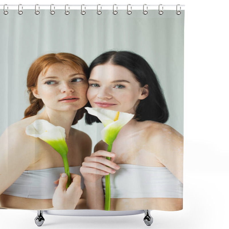 Personality  Smiling Woman With Vitiligo Holding Flower Near Freckled Friend Isolated On Grey  Shower Curtains