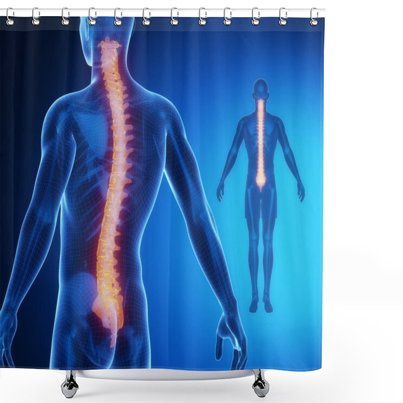 Personality  SPINE Bones Anatomy Scan Shower Curtains