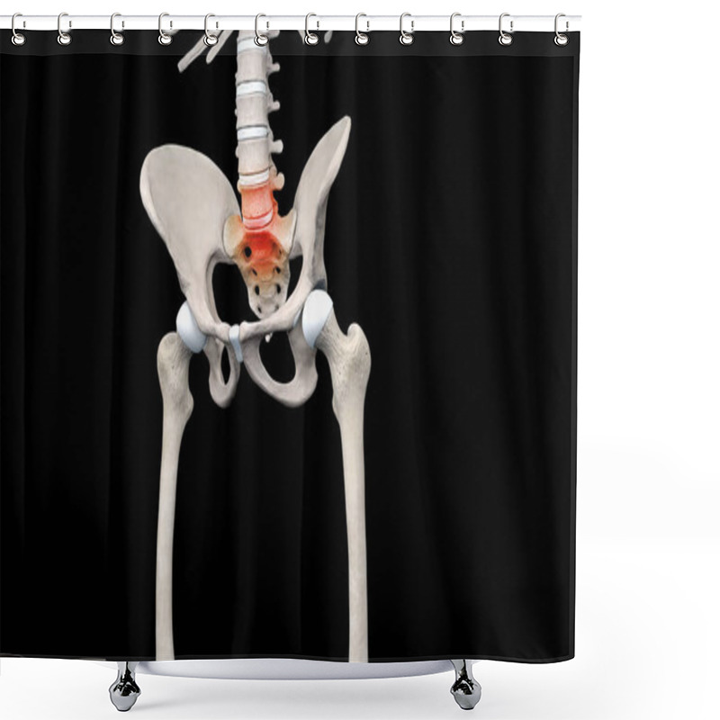 Personality  Lumbar Pain On Skeleton Pelvic Region Shower Curtains