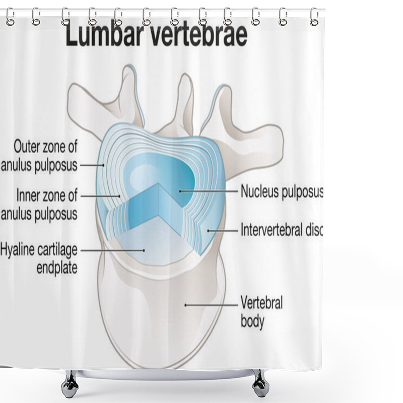 Personality  Illustration Showing Healthy Lumbar Vertebrae And Intervertebral Disc. Labeled Illustration Shower Curtains